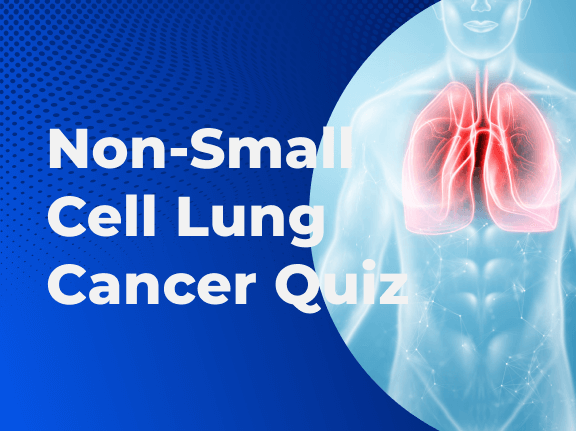 Non-Small Cell Lung Cancer Quiz